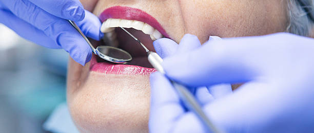 Best Broken or Chipped Tooth Repair in Mcsherrystown, PA