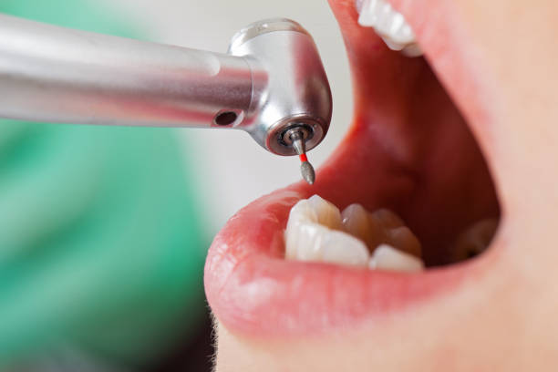 Best Walk-In Emergency Dental Services in Mcsherrystown, PA
